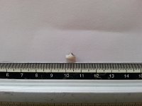 20150731 191047  31 July - how not to start the day: broken molar fragment
