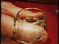 10626520 1755161204703392 7163730471148932351 n  The bandaged finger than caused a lot of problems since Dent Parachée