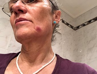 State of the Face April 16 2019