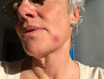 State of the Face May 12 2019