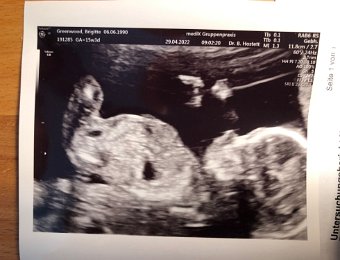 Happenings in Zurich