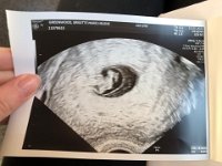 Baby on March 11, 2022