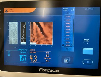 Sleep Watching and Liver Scan